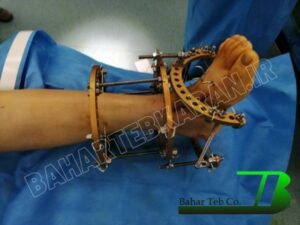 جراحی پای کوتاه