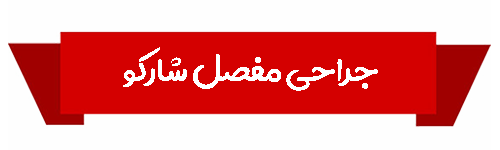 مفصل