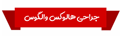 هالوکس