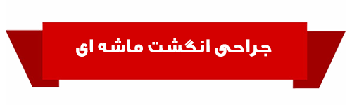جراحی ماشه ای